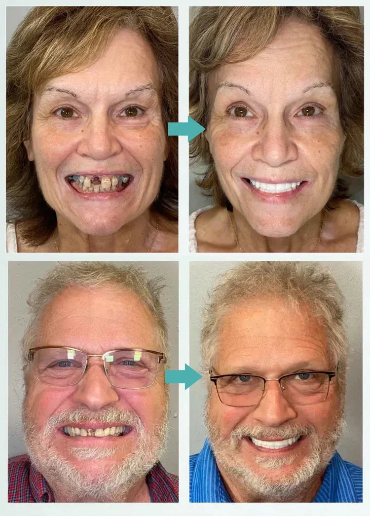 Denturex™ - Rengör på riktigt – inte bara på ytan